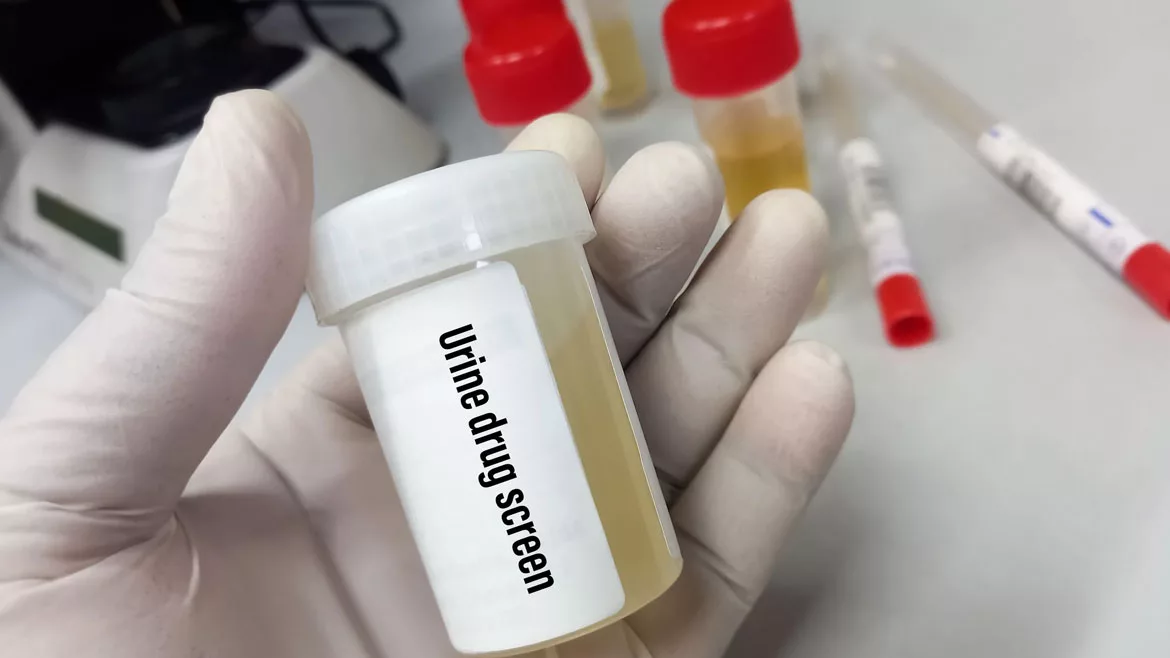 drug screen
